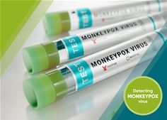 R-Biopharm announces test to detect monkeypox virus R-Biopharm announces test to detect monkeypox virus