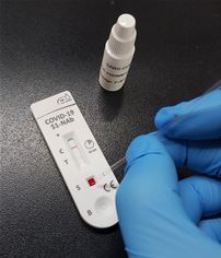 Coronavirus: An antibody test is a good way to find out about one's own immune status Coronavirus: An antibody test is a good way to find out about one's own immune status