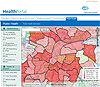 Birmingham life expectancy