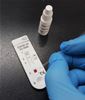 Coronavirus: An antibody test is a good way to find out about one's own immune status