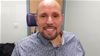 Steve Verze/3D printed prosthetic eye